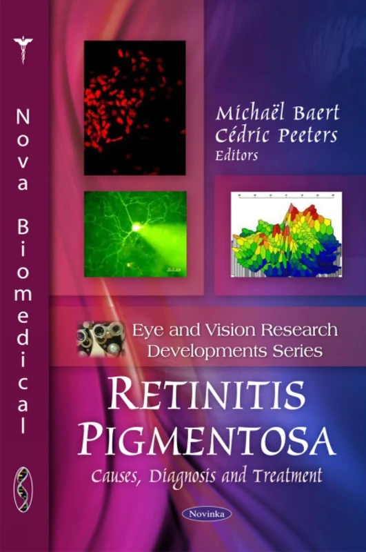 Retinitis Pigmentosa: Causes, Diagnosis and Treatment Book