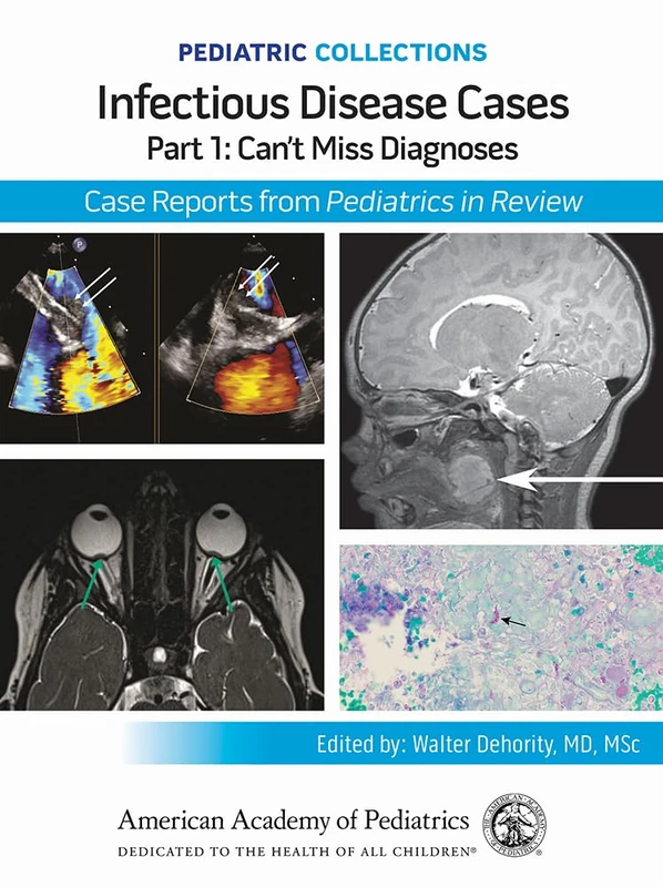 Infectious Disease Cases: Part 1: Can't Miss Diagnoses: Case Reports from Pediatrics in Review (Pediatric Collections)