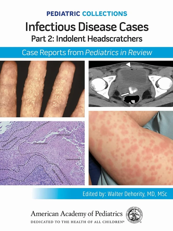 Infectious Disease Cases: Part 2: Indolent Head Scratchers: Case Reports from Pediatrics in Review (Pediatric Collections)