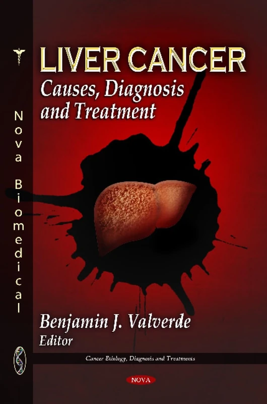 Liver Cancer: Causes, Diagnosis & Treatment (Cancer Etiology, Diagnosis and Treatments)