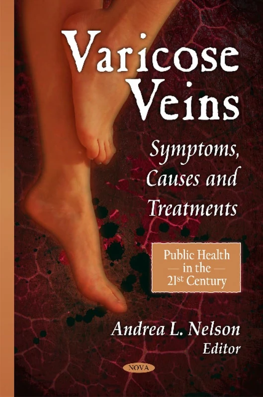 Varicose Veins: Symptoms, Causes & Treatments (Public Health in the 21st Century)