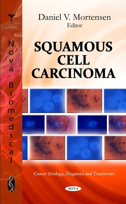 SQUAMOUS CELL CARCINOMA (Cancer Etiology, Diagnosis and Treatments)