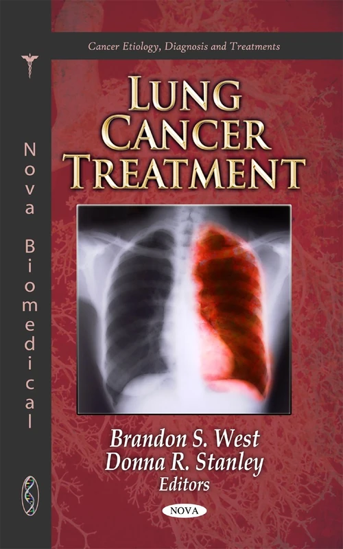 Lung Cancer Treatment (Cancer Etiology, Diagnosis and Treatments)