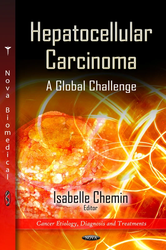 Hepatocellular Carcinoma: A Global Challenge (Cancer Etiology, Diagnosis & Treatments Series)