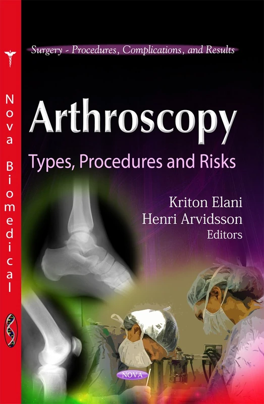 Arthroscopy: Types, Procedures & Risks (Surgery -- Procedures, Complications & Results Series) (Surgery-procedures, Complications, and Results)