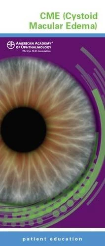 CME (Cystoid Macular Edema)
