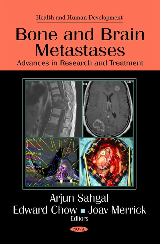 Bone & Brain Metastases: Advances in Research & Treatment (Health and Human Development)