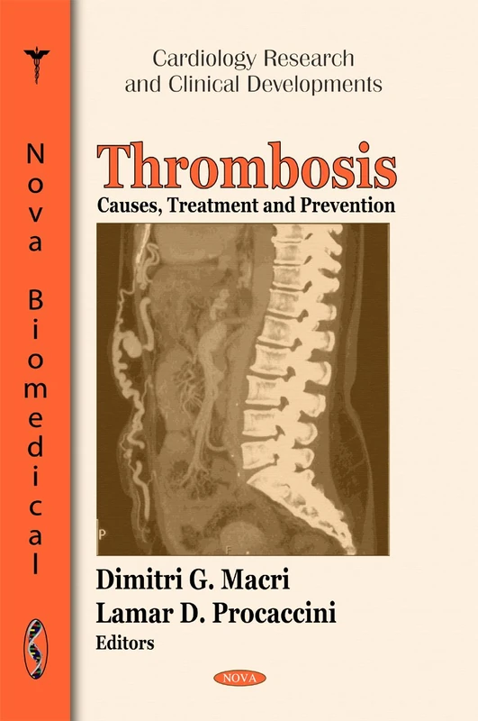 Thrombosis: Causes, Treatment & Prevention (Public Health in the 21st Century Series) (Cardiology Research and Clinical Developments)