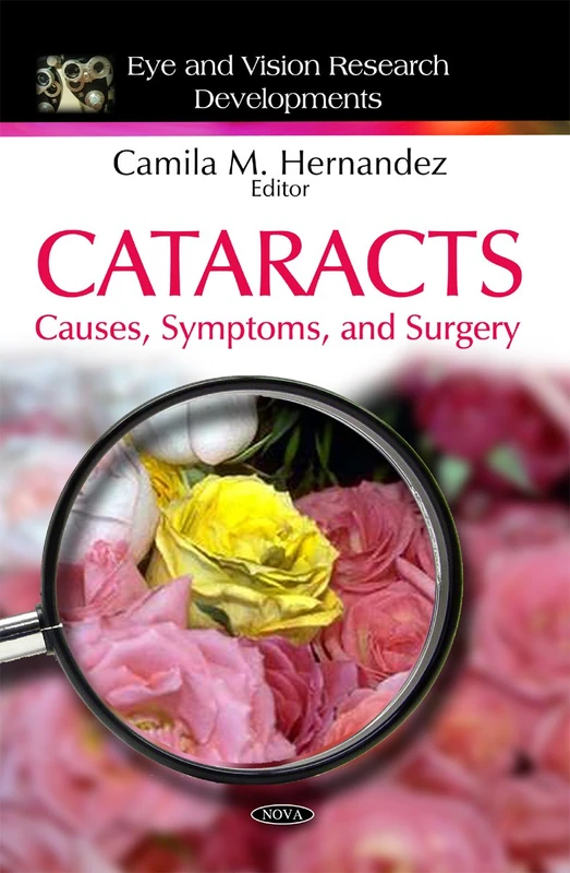 Cataracts: Causes, Symptoms, & Surgery - Research Book