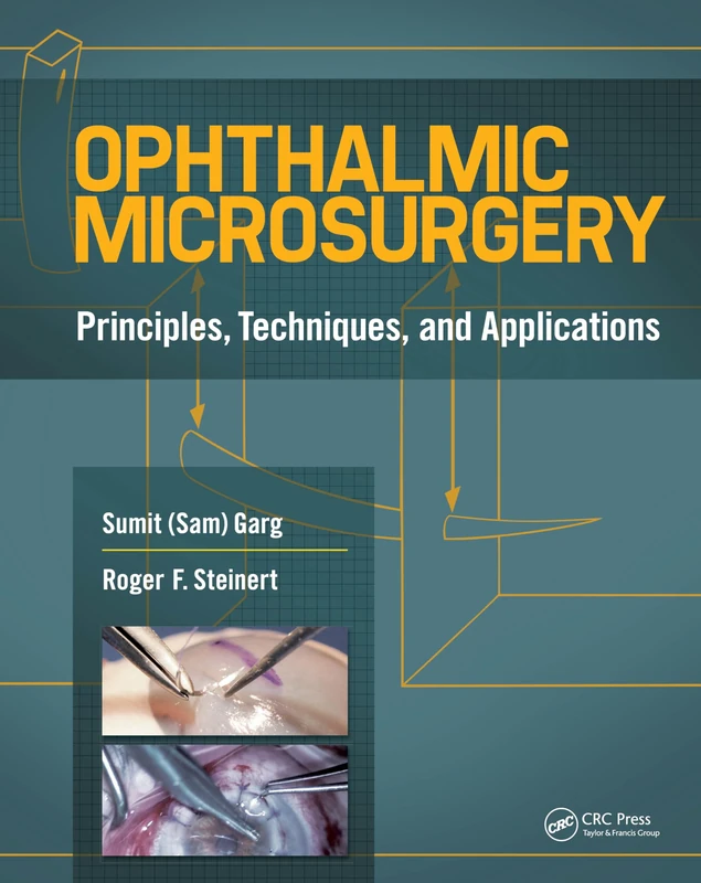 Slack Ophthalmic Microsurgery: Principles, Techniques, and Applications