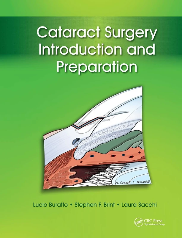 Cataract Surgery: Introduction and Preparation