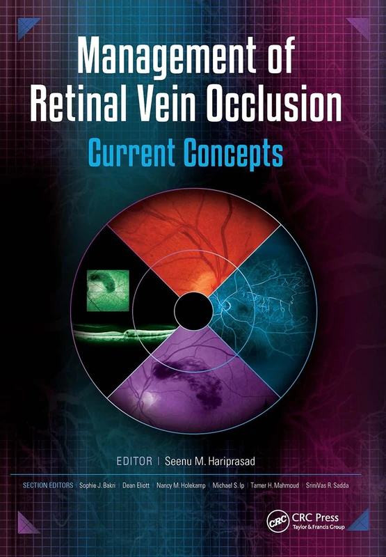 Slack Management of Retinal Vein Occlusion: Current Concepts