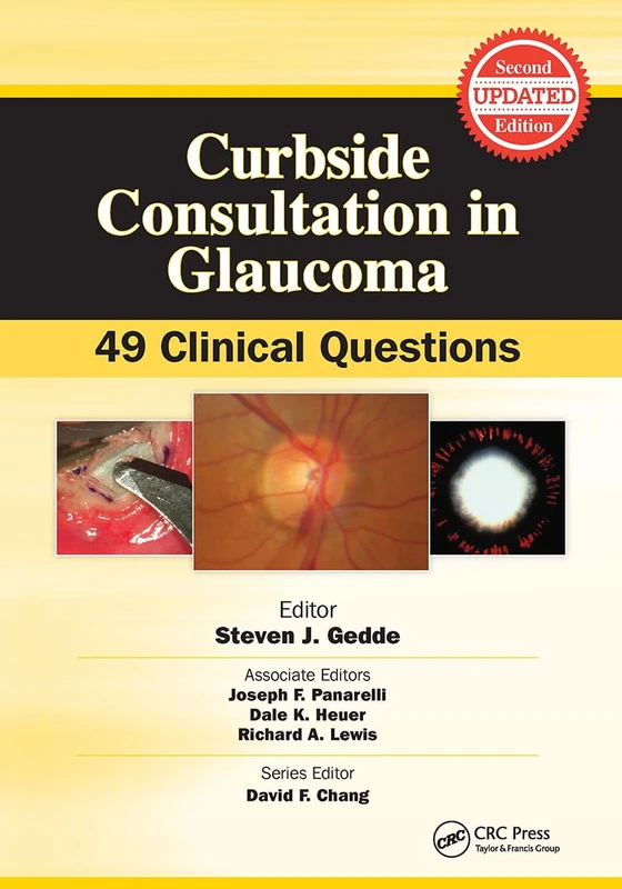 Curbside Consultation in Glaucoma: 49 Clinical Questions (Curbside Consultation in Ophthalmology)