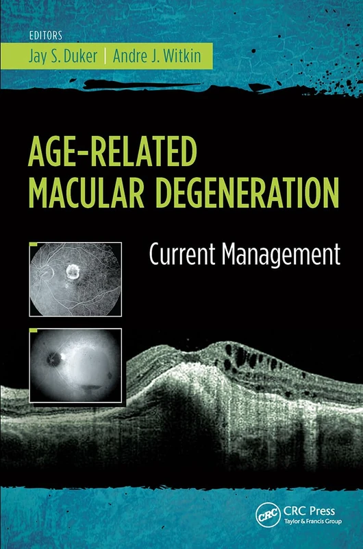Age-Related Macular Degeneration: Current Management