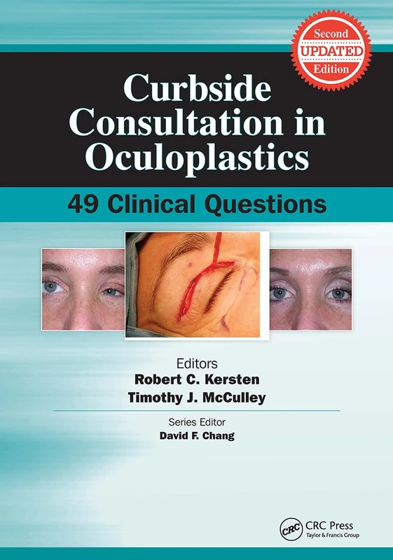 Curbside Consultation in Oculoplastics: 49 Clinical Questions (Curbside Consultation in Ophthalmology)
