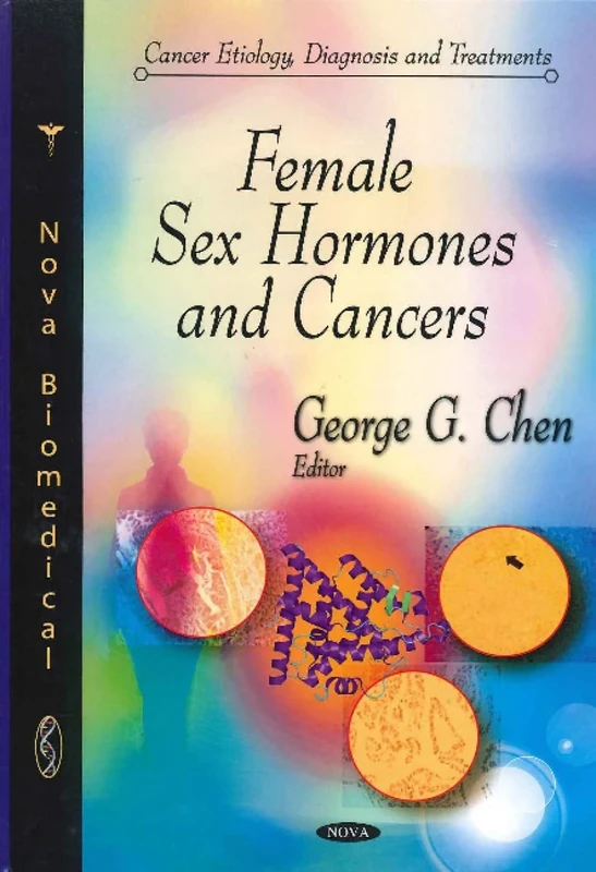 Female Sex Hormones & Cancers (Cancer Etiology, Diagnosis & Treatments Series) (Cancer Etiology, Diagnosis and Treatments)
