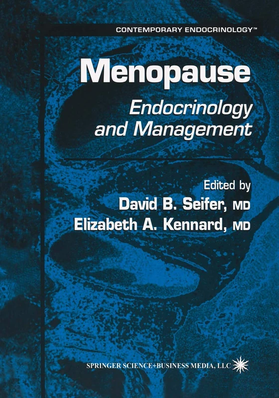 Menopause: Endocrinology and Management: 18 (Contemporary Endocrinology, 18)