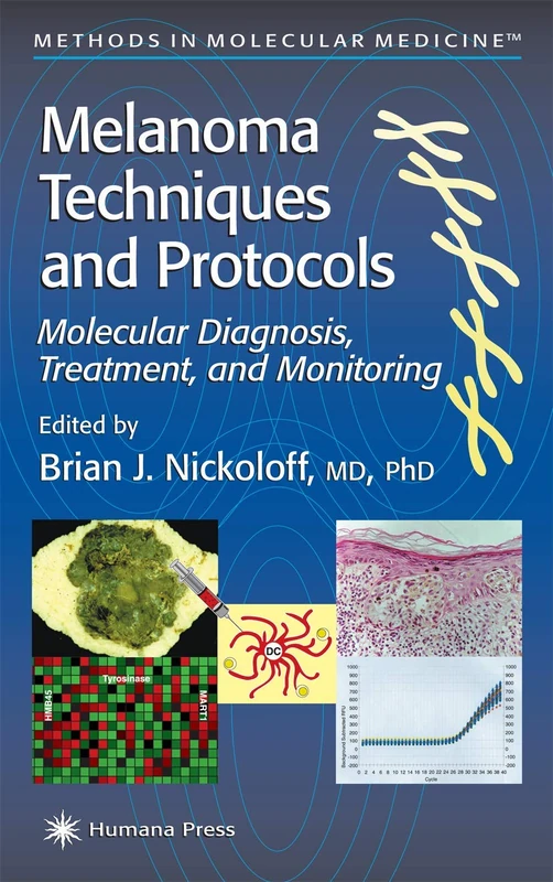 Melanoma Techniques and Protocols: Molecular Diagnosis, Treatment, and Monitoring: 61 (Methods in Molecular Medicine, 61)