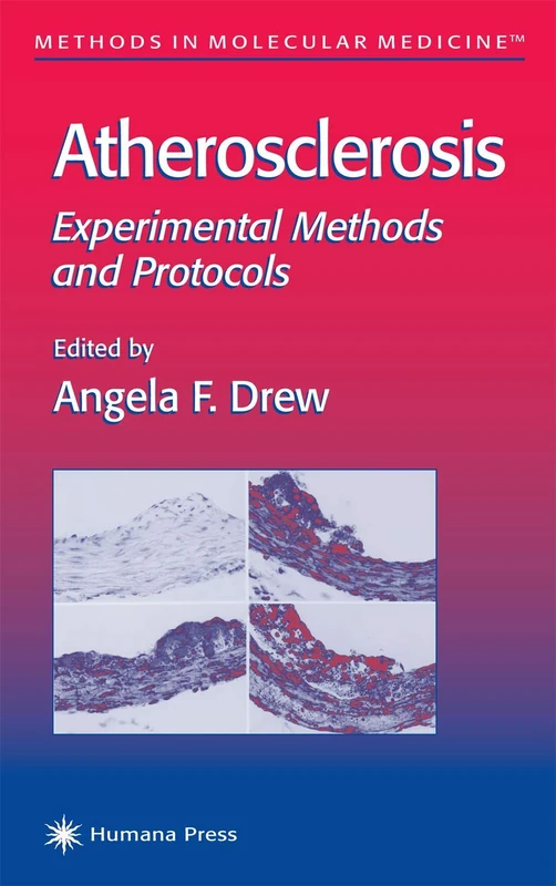Atherosclerosis: Experimental Methods and Protocols: 52 (Methods in Molecular Medicine, 52)