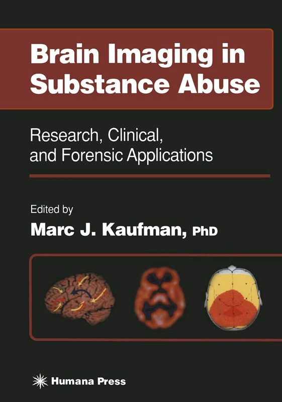Brain Imaging in Substance Abuse: Research, Clinical, and Forensic Applications (Forensic Science and Medicine)