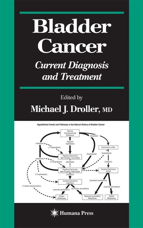 Bladder Cancer: Current Diagnosis and Treatment (Current Clinical Urology)