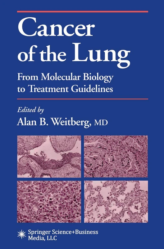 Cancer of the Lung: From Molecular Biology to Treatment Guidelines (Current Clinical Oncology)