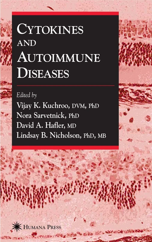 Humana Cytokines and Autoimmune Diseases - Medical Research Book