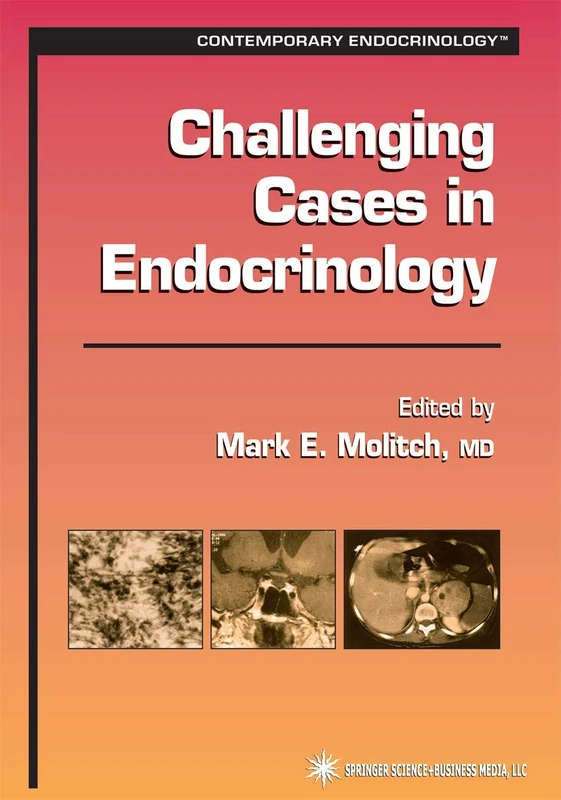 Challenging Cases in Endocrinology (Contemporary Endocrinology)