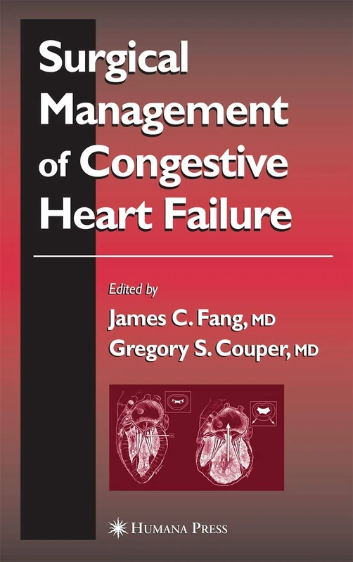 Surgical Management of Congestive Heart Failure (Contemporary Cardiology)