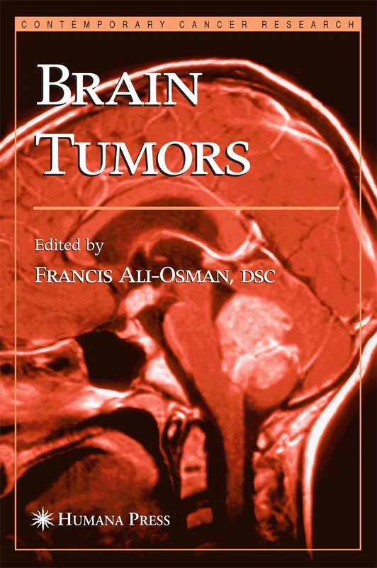 Brain Tumors (Contemporary Cancer Research)