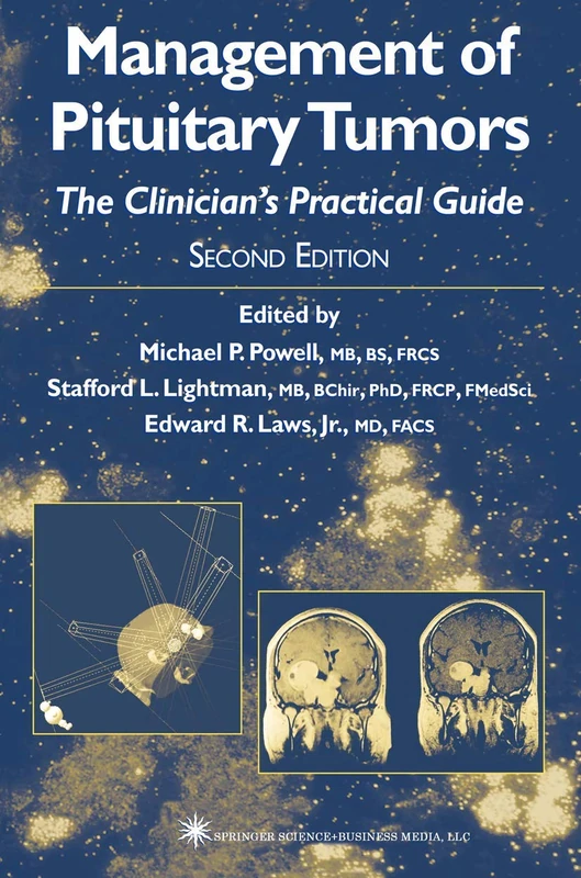 Management of Pituitary Tumors: The Clinician’s Practical Guide