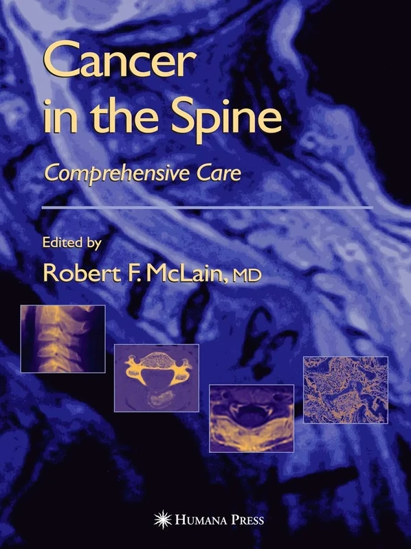 Cancer in the Spine: Comprehensive Care (Current Clinical Oncology)