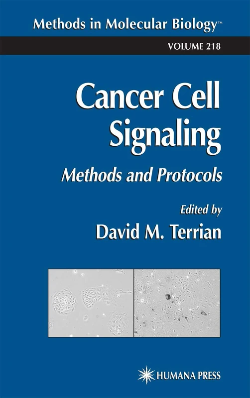 Humana Cancer Cell Signaling: Methods and Protocols 218