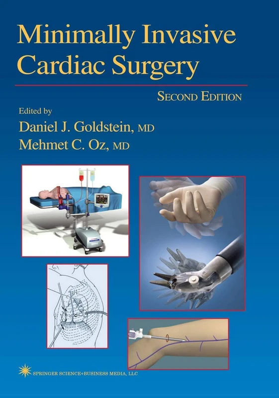 Minimally Invasive Cardiac Surgery (Contemporary Cardiology)