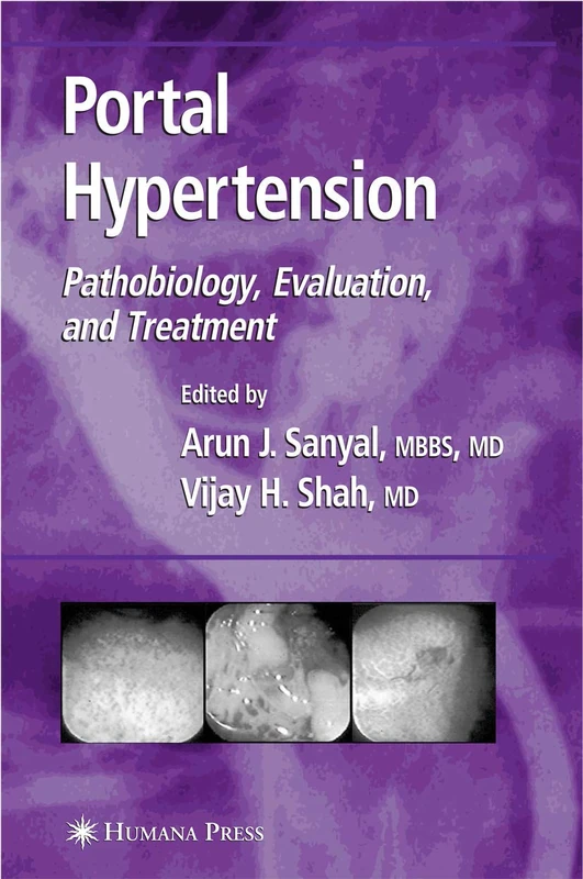 Humana Portal Hypertension: Pathobiology and Treatment Book