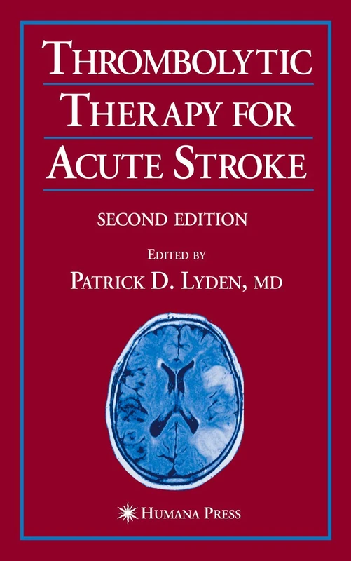 Thrombolytic Therapy for Acute Stroke (Current Clinical Neurology)