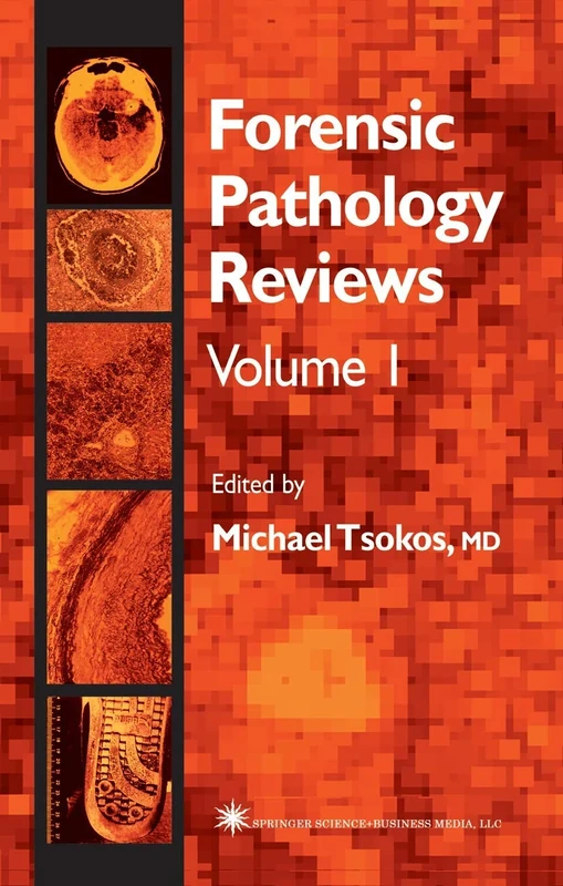 Forensic Pathology Reviews: 1