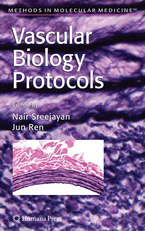 Vascular Biology Protocols: 139 (Methods in Molecular Medicine, 139)