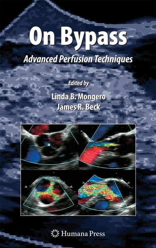 Humana On Bypass: Advanced Perfusion Techniques Book