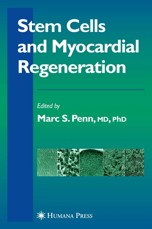 Stem Cells and Myocardial Regeneration (Contemporary Cardiology)