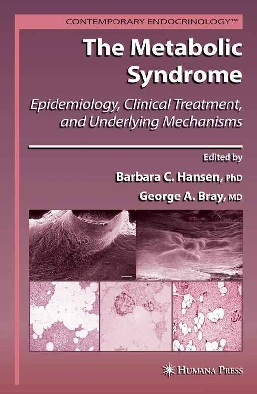 The Metabolic Syndrome:: Epidemiology, Clinical Treatment, and Underlying Mechanisms (Contemporary Endocrinology)