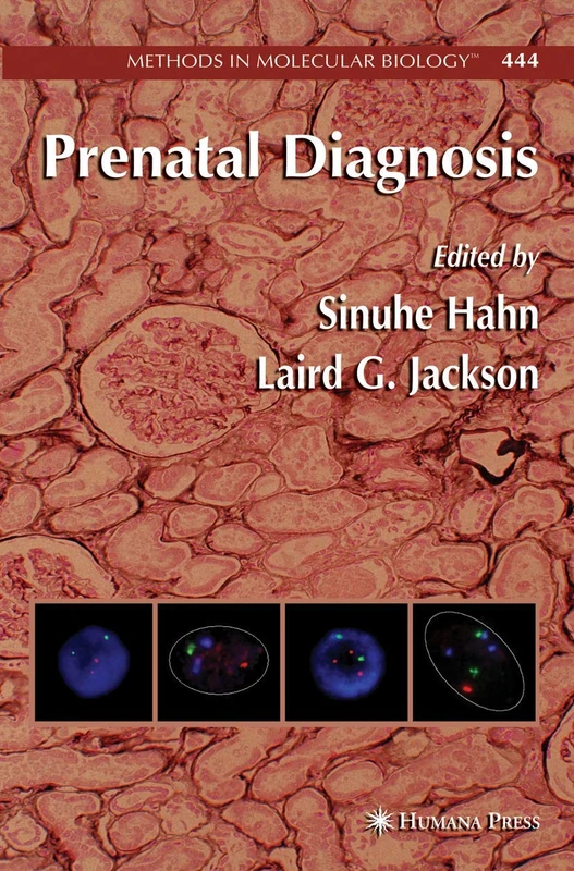Humana Prenatal Diagnosis: 444 (Methods in Molecular Biology)