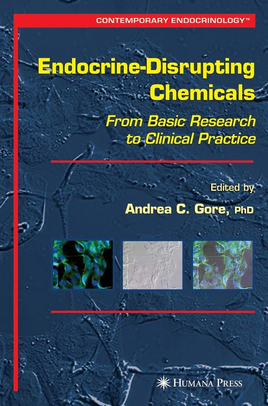 Endocrine-Disrupting Chemicals: From Basic Research to Clinical Practice (Contemporary Endocrinology)
