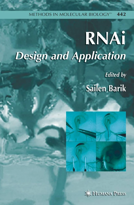 RNAi: Design and Application: 442 (Methods in Molecular Biology, 442)