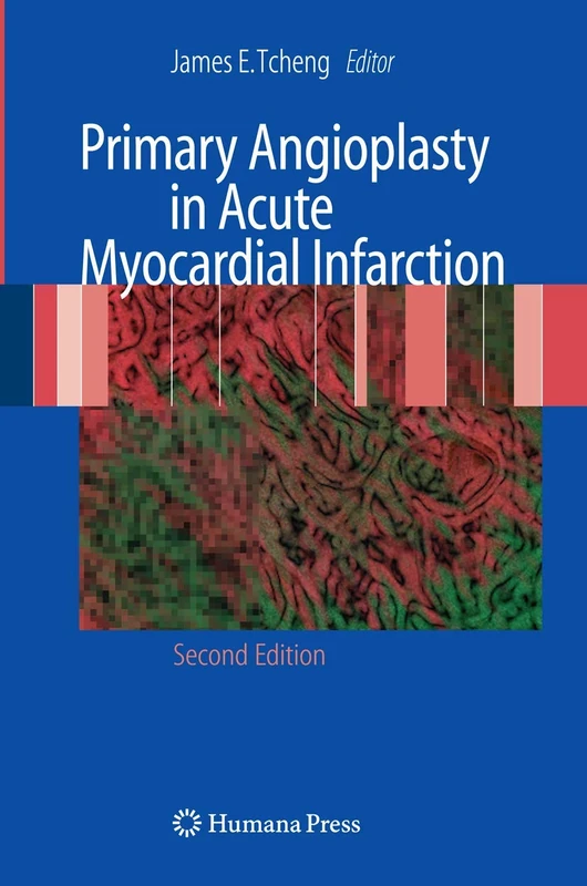 Humana Primary Angioplasty in Acute Myocardial Infarction Book