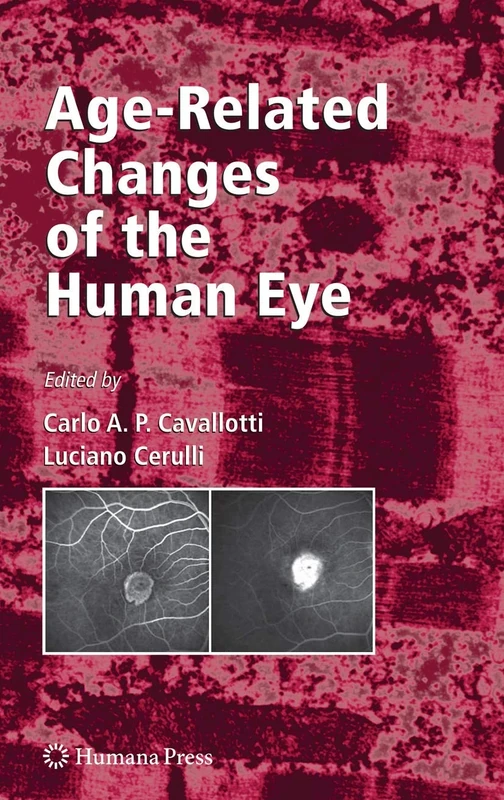 Age-Related Changes of the Human Eye (Aging Medicine)