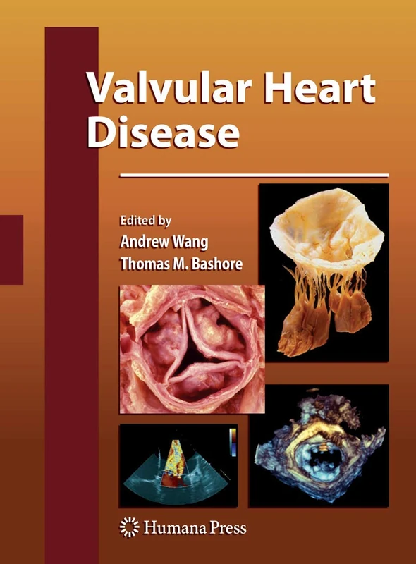 Valvular Heart Disease (Contemporary Cardiology)