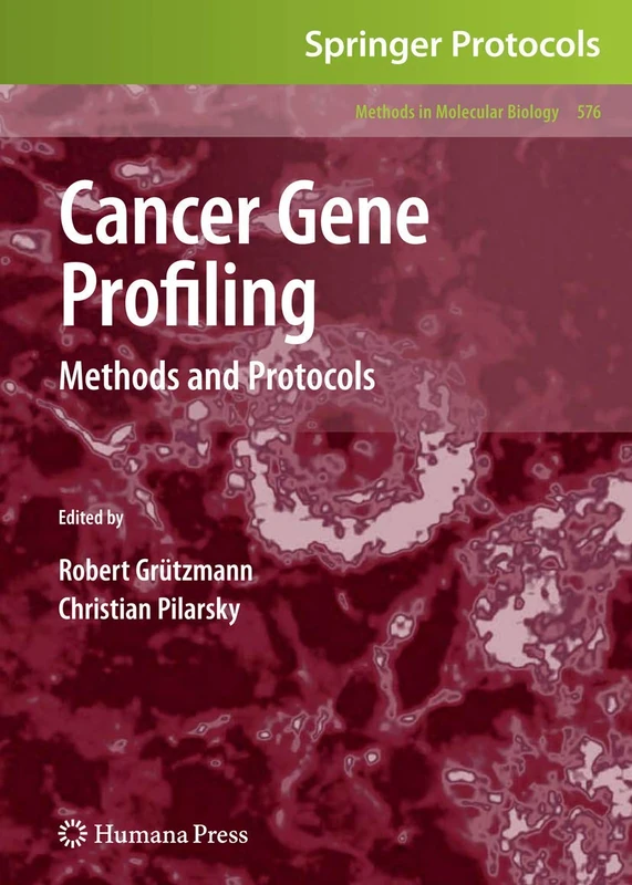 Humana Cancer Gene Profiling: Methods and Protocols 576