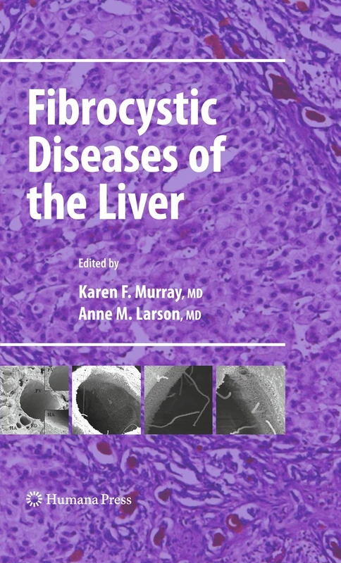 Fibrocystic Diseases of the Liver (Clinical Gastroenterology)