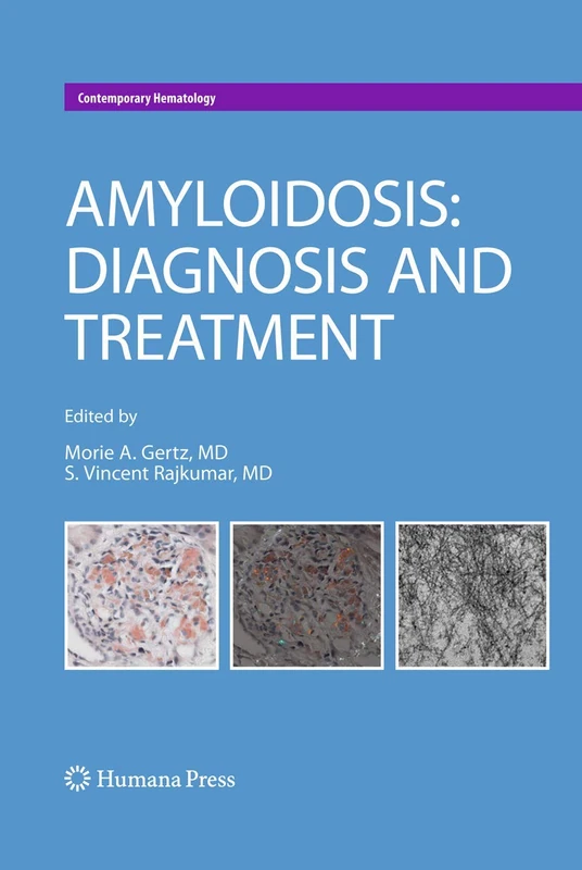 Amyloidosis: Diagnosis and Treatment - Humana Medical Text